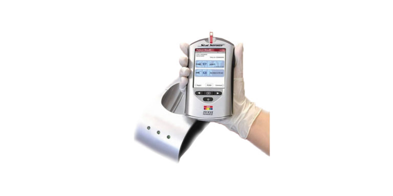 Stat Sensor – Examen Creatinina 30 segundos